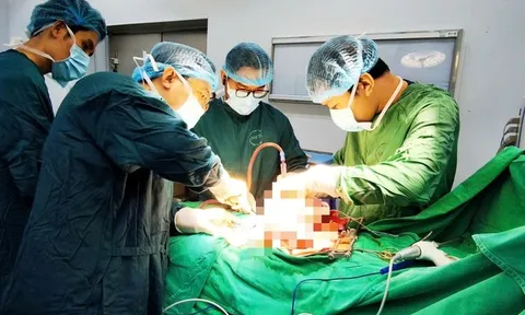 Khối u buồng trứng khổng lồ chiếm gần trọn bụng dưới của bệnh nhân 20 tuổi