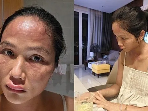 Chuyện gì xảy ra với H'Hen Niê sau khi xuất hiện với gương mặt khác lạ