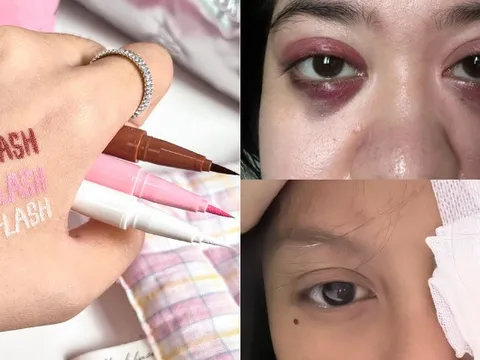 Phấn mắt PINKFLASH dính bê bối lớn: Người dùng bị lẹo mắt hàng loạt, hãng tiêu huỷ, đền tiền gấp đôi