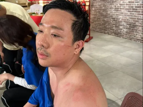 Trấn Thành tiếp tục phải trả giá