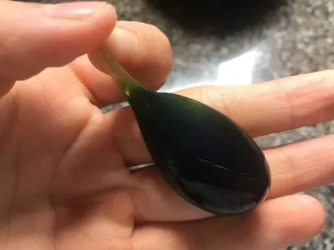 Người đàn ông 38 tuổi suýt chết vì nuốt mật cá trắm để "tăng cường sinh lực"