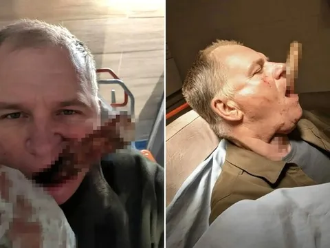 Trượt chân khi lao động, người đàn ông gặp tai nạn nghiêm trọng