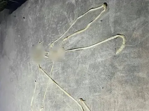 Bị rối loạn tiêu hóa, người đàn ông phát hiện "vật thể lạ" dài gần 10m